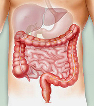 colon-cleanse